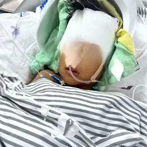 7岁男童被同村男子砸致颅骨粉碎性骨折,家属他说我儿子骑车压了他的鸡食