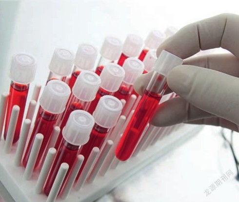 医疗的未来检验体液寻找健康线索