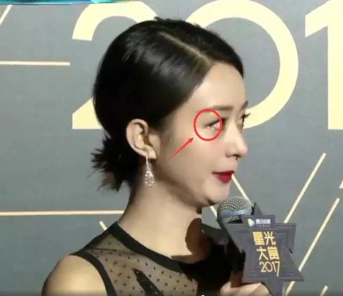 赵丽颖红毯冻哭不是事,皮肤才是大问题