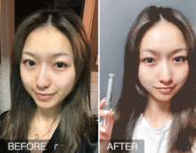 医生提醒如果你正长皱纹,快试试这个新方法,50岁还是少女脸