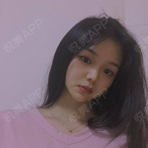 明天就大年三十了,20年终于要结束了,这几天在家里拿...祛斑悦美整形
