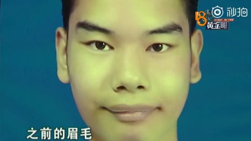 发际线男孩刷屏朋友圈,网友纷纷为他做表情包明明很心疼,为什么我这么想笑