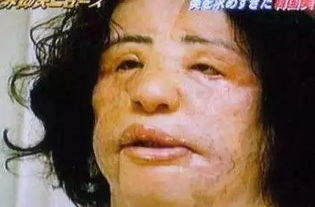 又一花季少女因整形死亡,这些都是前车之鉴