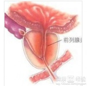 前列腺炎的危害严重吗