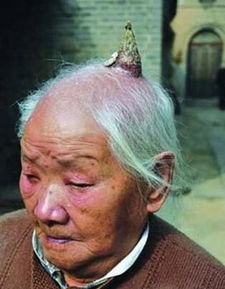 老人头上长出牛角难道要变异吗