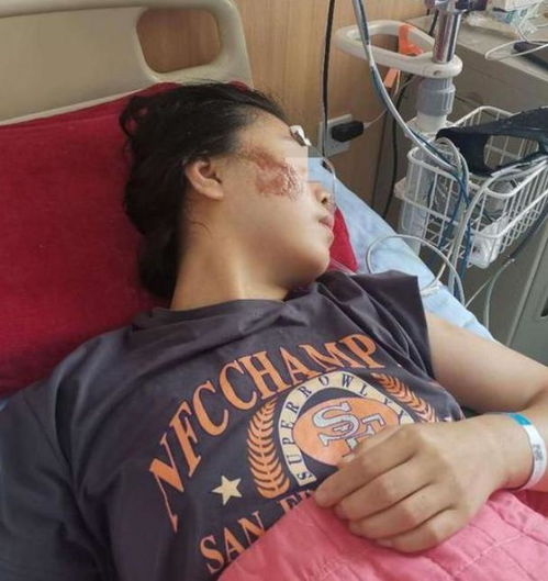 邯郸一女子和男友分手,却惨遭前男友驾车反复碾压,送医后缝了30多针