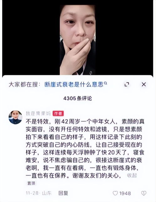 42岁女子经历20天断崖式衰老8个生活习惯是衰老加速器