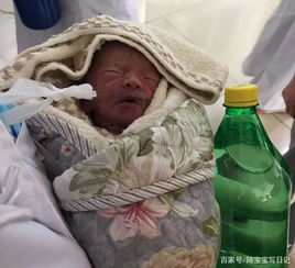 宝宝生下来没有肛门,妻子找医生理论,医生都是你们自己造成的
