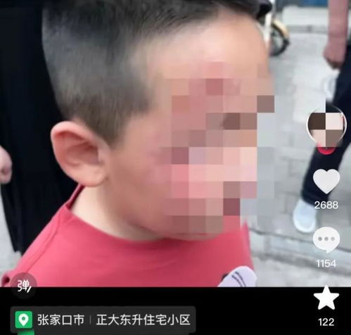 五岁孩子喊邻居儿子被痛扁你不教育,别人的教育会让你后悔