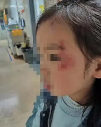 女子接了孩子回家路上,突然掉进了洞里