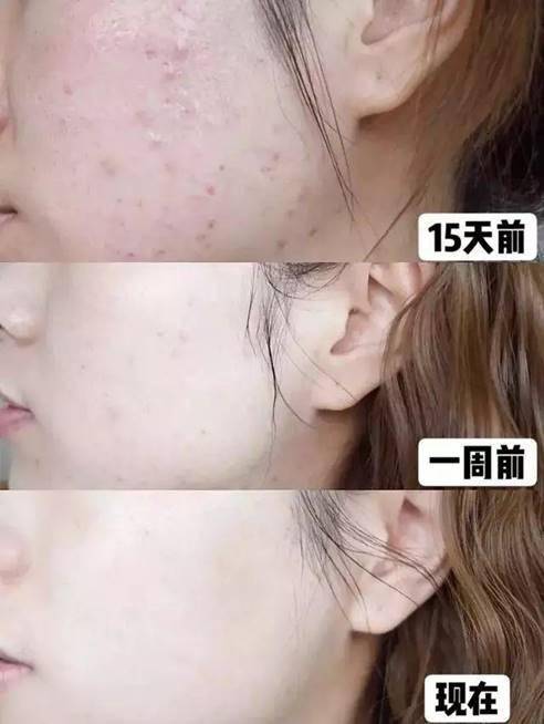 同样40岁,不爱洗脸和爱洗脸的女生,一眼能看出差距
