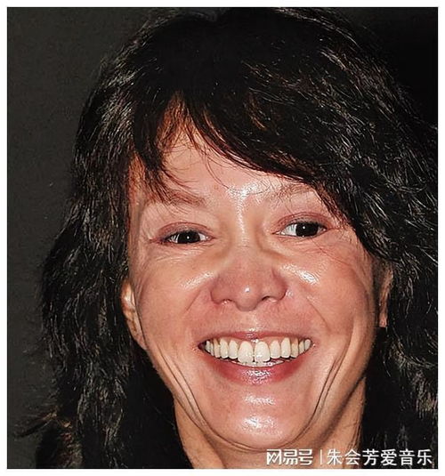 蛇精脸歪下巴面容扭曲,这五位女星整容失败面目全非,实在可惜