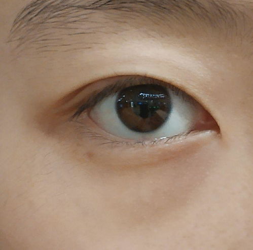 22岁女生,眼部图如下,有推荐的眼霜吗