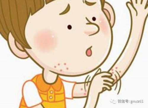 每一次的红点反复,都会加重过敏性紫癜吗