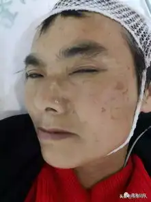 广东澄海中年女子受伤送医,急寻家属,穿红色衣服,您认识她吗