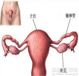 多囊卵巢囊肿的原因
