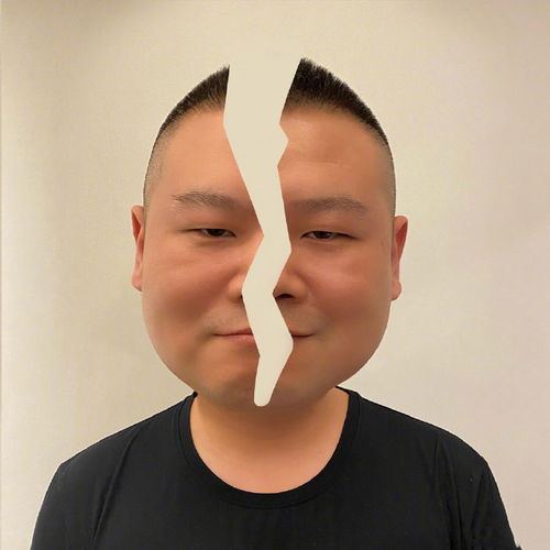 岳云鹏晒自己新表情包,第二张像胖版哪吒,头裂照网友帮他缝住了