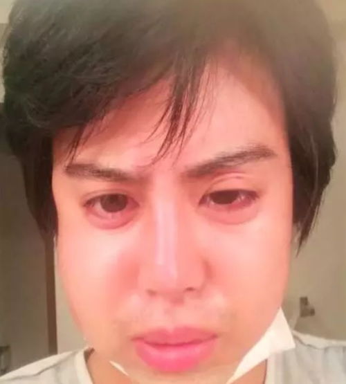 26岁男子整容40次变外星人,被多名富婆供养月入500万