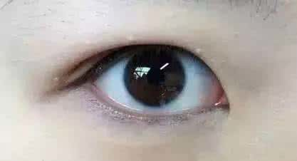 双眼皮类型有哪些什么样的类型才适合你