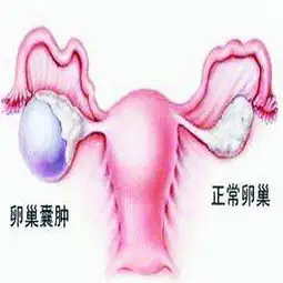北京建国医药专家始终专注女性健康