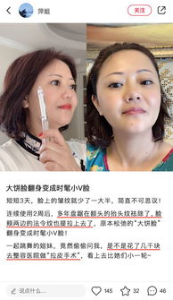 医生提醒如果你正长皱纹,快试试这个新方法,50岁还是少女脸