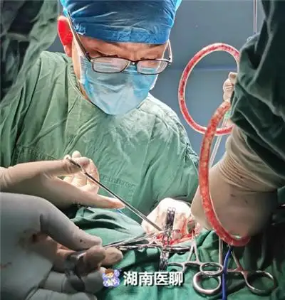 35岁男人微信用什么头像肠癌