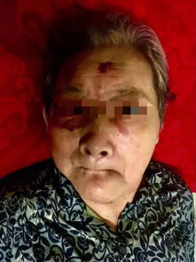 丧心病狂年轻男子街头暴打87岁老奶奶,只因老人一句善意提醒警方该男子因涉嫌寻衅滋事罪已被刑拘