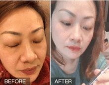 医生提醒如果你正长皱纹,快试试这个新方法,50岁还是少女脸