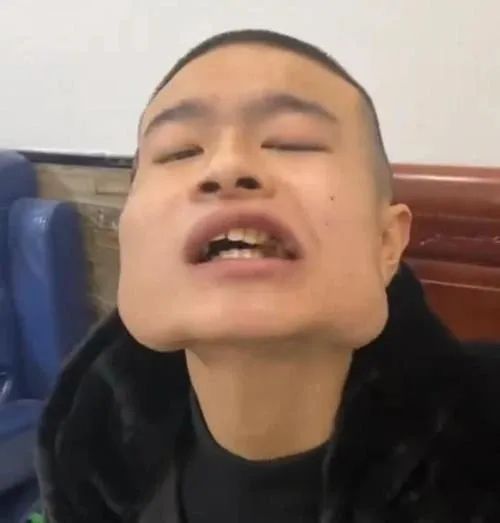 男子8年吃了40多万脸变正方形当心,一级致癌
