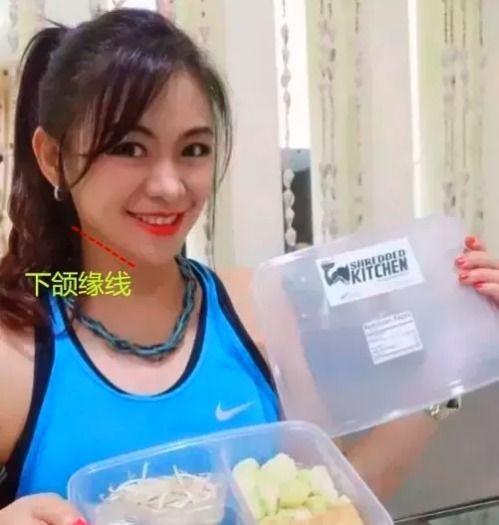 做了大v线雕在皮肤内断了取出经历,我太难了