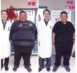 35岁男子因300多斤体重而遭罪