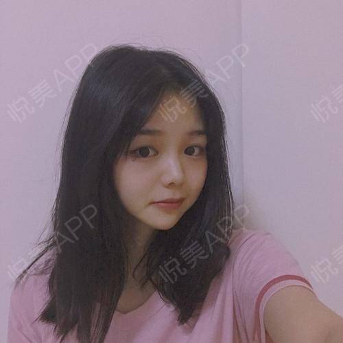 明天就大年三十了,20年终于要结束了,这几天在家里拿...祛斑悦美整形