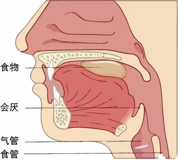 嗓子疼差点要了他的命专家出现这几种喉咙痛,千万别拖