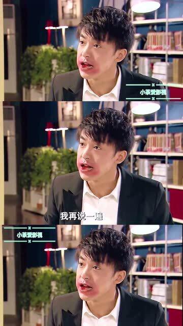 张伟小龙虾过敏实在是太真实了,请你告诉我这个化妆技术怎么练的