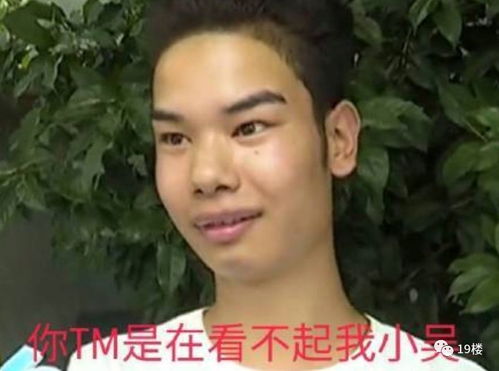 昨天最火的发际线男孩表情包,你收藏了吗本尊却说