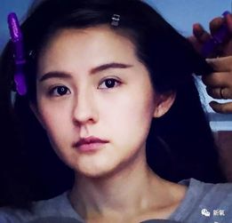 她学闺蜜杨幂做同款手术,如今苹果肌要爆炸