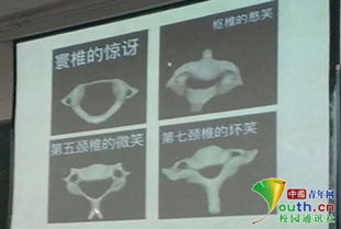 高校教师课堂上展示颈椎表情包解剖课成了斗图课