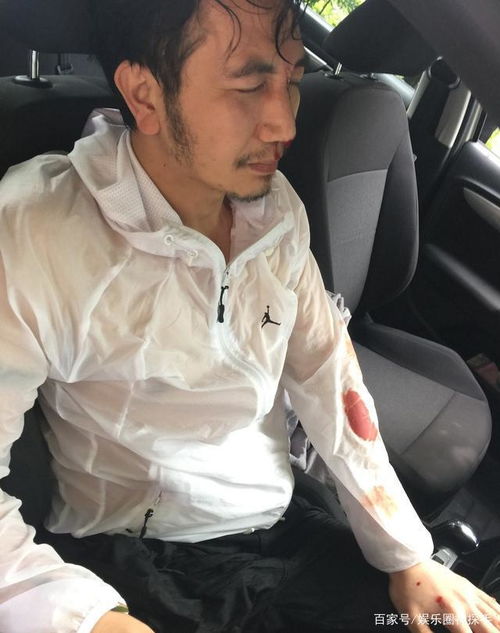 林生斌口碑反转事件始末,近2年资产情况成网友关注焦点