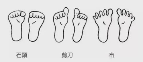 穿20年高跟鞋,她的脚竟变成这样最爱高跟鞋的女人也不想碰它了