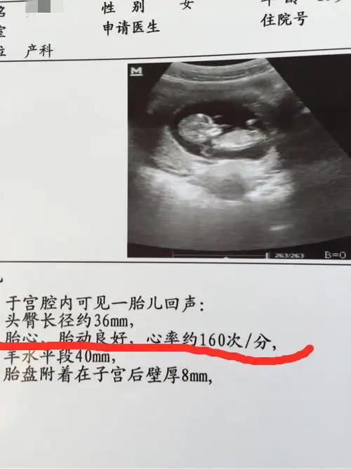 谢女士38岁,双侧输卵管堵塞做试管婴儿,头胎生下一枚健康男宝