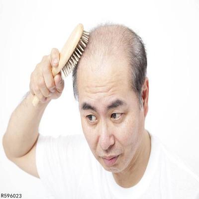 24岁男的脱发什么引起的四个原因会导致男性脱发