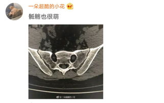 高校教师课堂上展示颈椎表情包,我才不羡慕有这样的老师