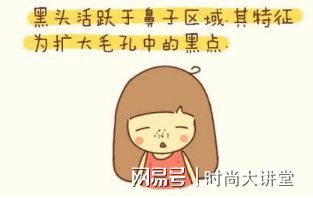 霖雨老师分享如何治疗痘痘和去黑头