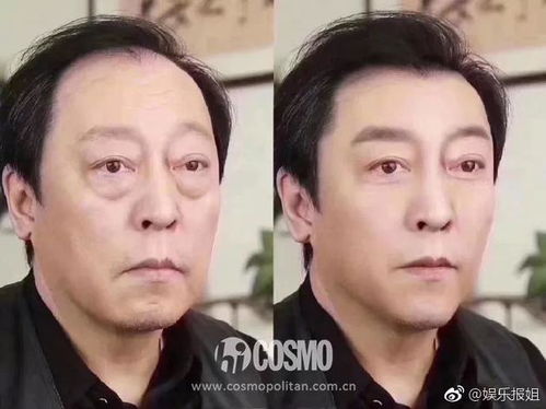 你的眼袋比苏大强的还大这可怎么办啊