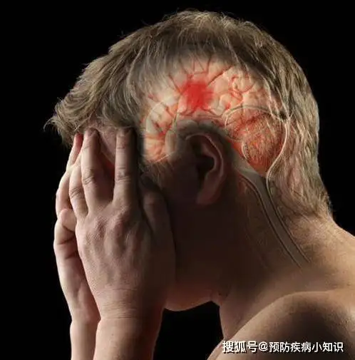 35岁男子脑梗后瘫痪,医生提示这三种素食,或比肥肉升脂快