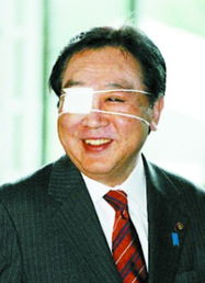 日本首相成了独眼龙